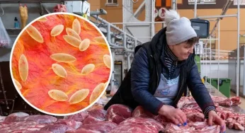 Вживали в’ялене м’ясо та сири: на Хмельниччині зареєстровано два лабораторно підтверджених випадки бруцельозу