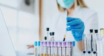 У Хмельницькому вводять попередній запис на здачу аналізів крові з вени
